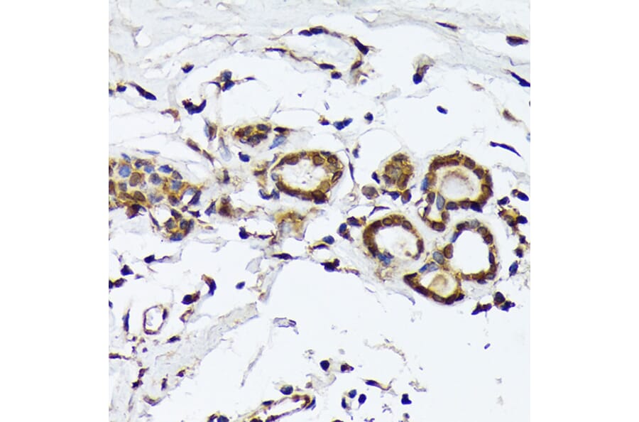 Immunohistochemistry - Anti-PSMD14 Antibody [ARC1655] (A309212) - Antibodies.com