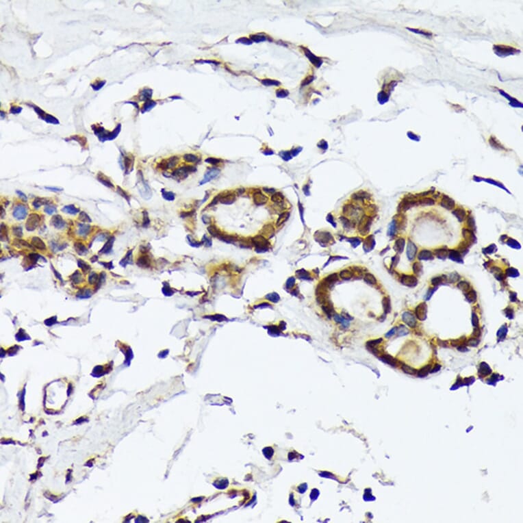 Immunohistochemistry - Anti-PSMD14 Antibody [ARC1655] (A309212) - Antibodies.com