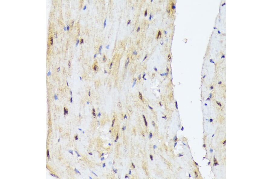 Immunohistochemistry - Anti-PSMD14 Antibody [ARC1655] (A309212) - Antibodies.com