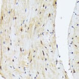 Immunohistochemistry - Anti-PSMD14 Antibody [ARC1655] (A309212) - Antibodies.com