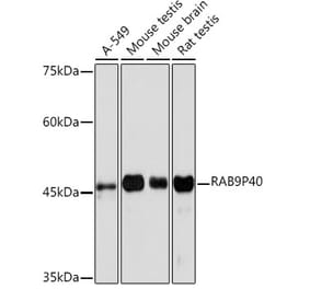 Western Blot - Anti-p40 Antibody [ARC2194] (A309213) - Antibodies.com