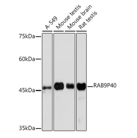 Western Blot - Anti-p40 Antibody [ARC2194] (A309213) - Antibodies.com