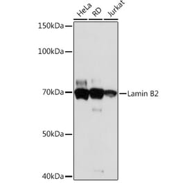 Western Blot - Anti-Lamin B2 Antibody [ARC1252] (A309214) - Antibodies.com