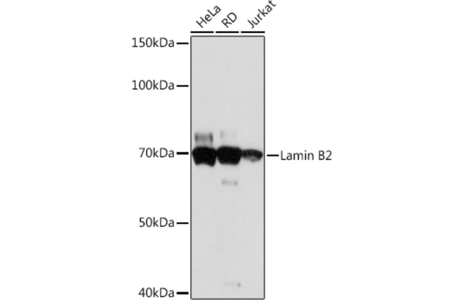 Western Blot - Anti-Lamin B2 Antibody [ARC1252] (A309214) - Antibodies.com