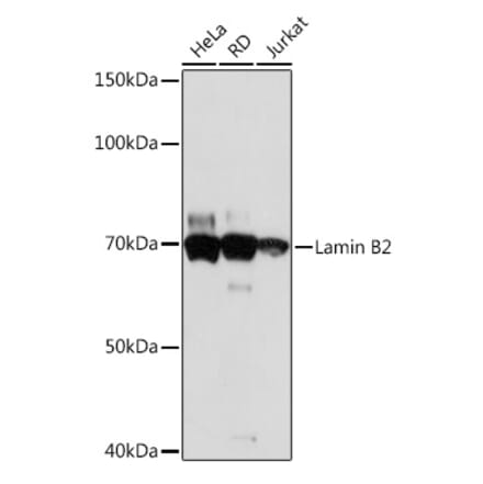 Western Blot - Anti-Lamin B2 Antibody [ARC1252] (A309214) - Antibodies.com