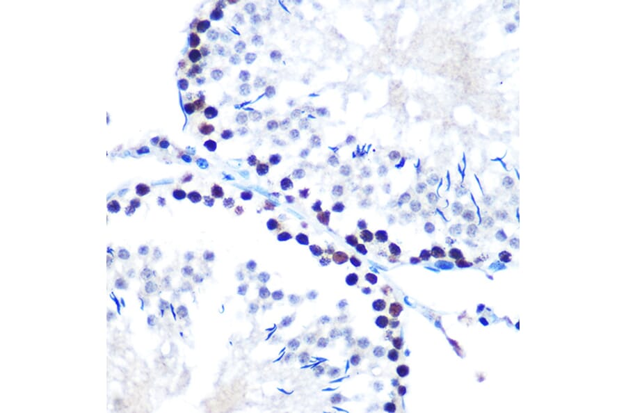Immunohistochemistry - Anti-mSin3A Antibody [ARC0745] (A309217) - Antibodies.com