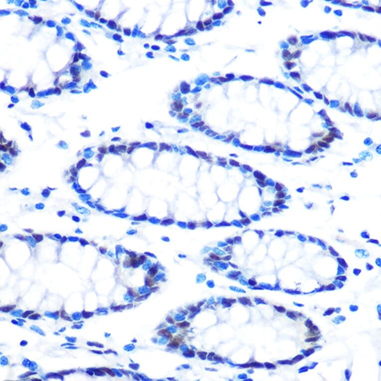 Immunohistochemistry - Anti-mSin3A Antibody [ARC0745] (A309217) - Antibodies.com