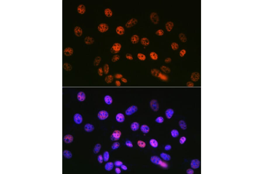 Immunofluorescence - Anti-mSin3A Antibody [ARC0745] (A309217) - Antibodies.com