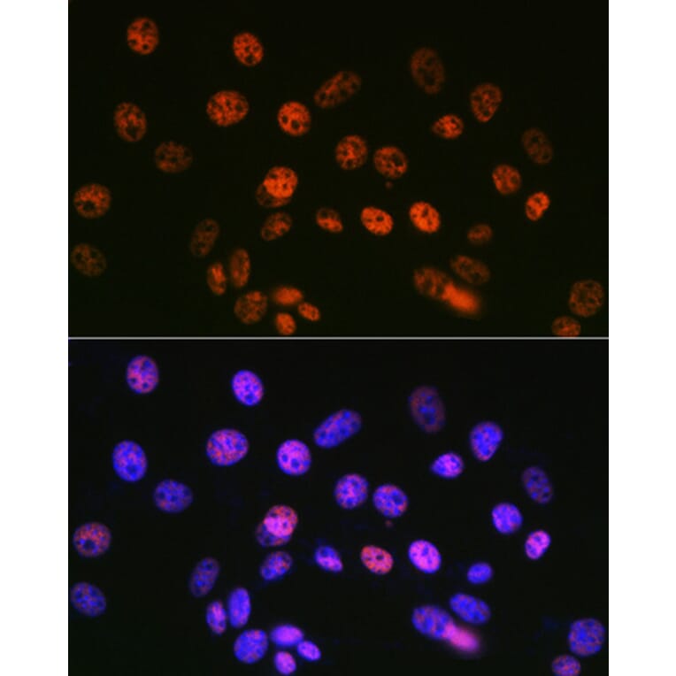 Immunofluorescence - Anti-mSin3A Antibody [ARC0745] (A309217) - Antibodies.com
