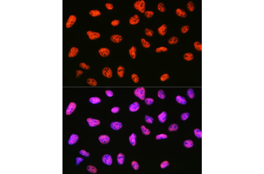 Immunofluorescence - Anti-mSin3A Antibody [ARC0745] (A309217) - Antibodies.com