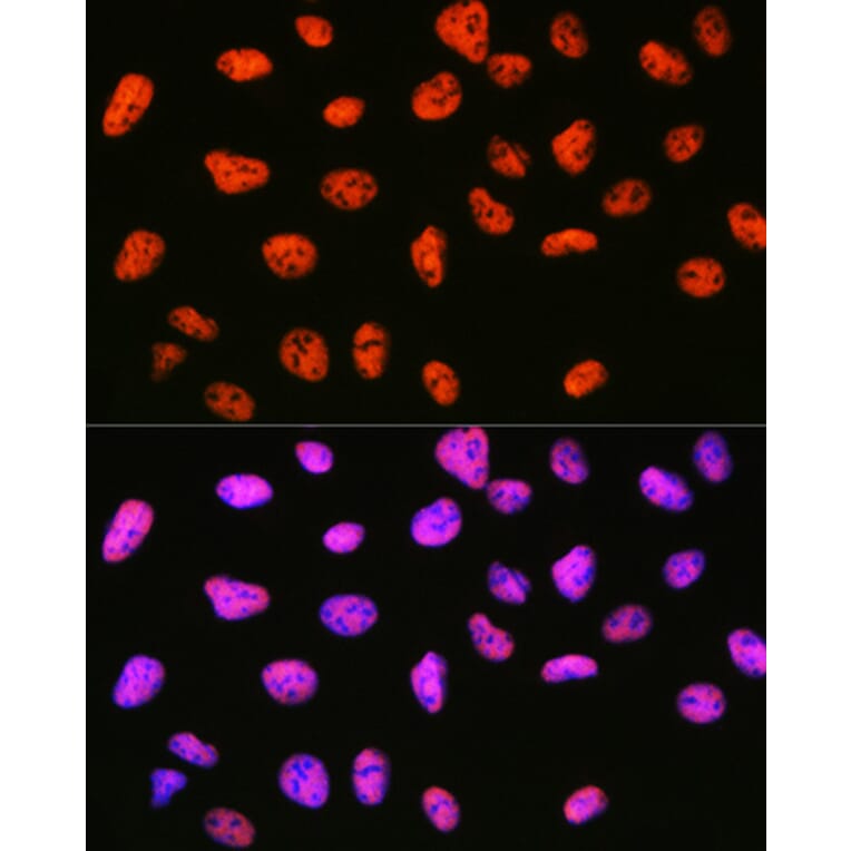 Immunofluorescence - Anti-mSin3A Antibody [ARC0745] (A309217) - Antibodies.com