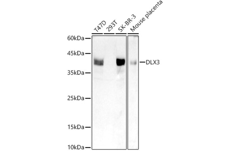 Western Blot - Anti-DLX3 Antibody [ARC2934] (A309218) - Antibodies.com
