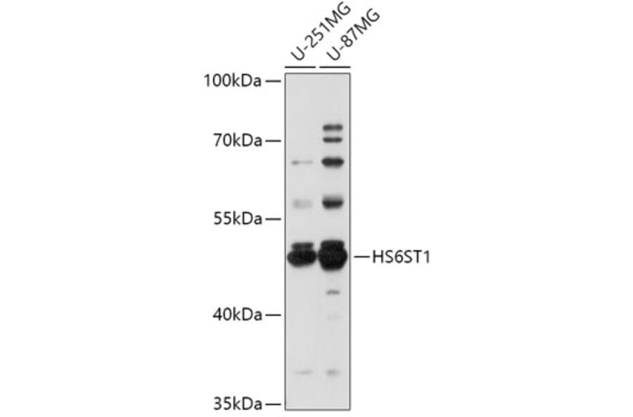 Western Blot - Anti-HS6ST1 Antibody (A309221) - Antibodies.com
