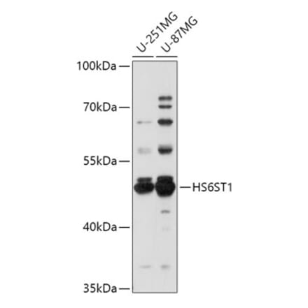 Western Blot - Anti-HS6ST1 Antibody (A309221) - Antibodies.com