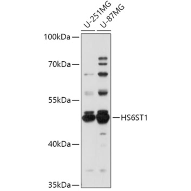 Western Blot - Anti-HS6ST1 Antibody (A309221) - Antibodies.com