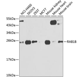 Western Blot - Anti-RAB1B Antibody (A309223) - Antibodies.com