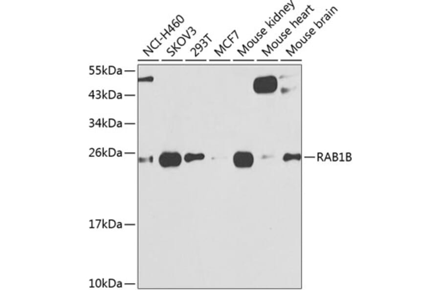 Western Blot - Anti-RAB1B Antibody (A309223) - Antibodies.com