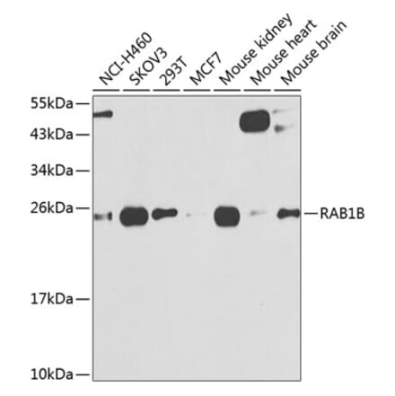 Western Blot - Anti-RAB1B Antibody (A309223) - Antibodies.com