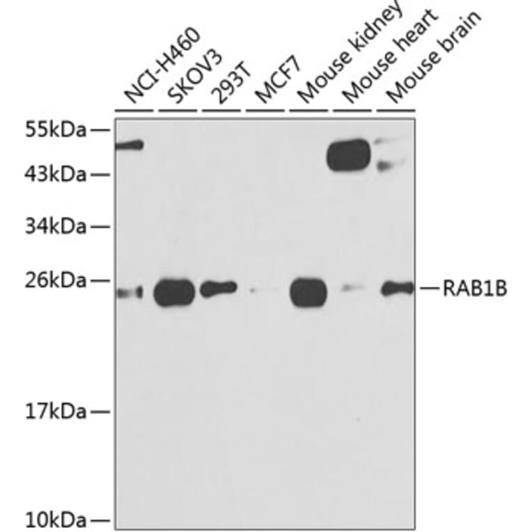 Western Blot - Anti-RAB1B Antibody (A309223) - Antibodies.com