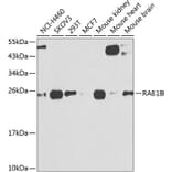 Western Blot - Anti-RAB1B Antibody (A309223) - Antibodies.com