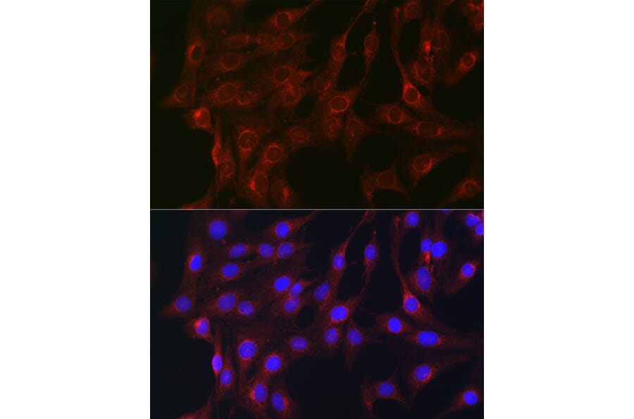 Immunofluorescence - Anti-RAB1B Antibody (A309223) - Antibodies.com