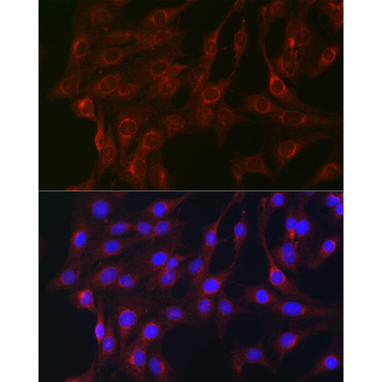 Immunofluorescence - Anti-RAB1B Antibody (A309223) - Antibodies.com