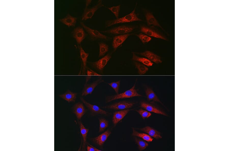 Immunofluorescence - Anti-RAB1B Antibody (A309223) - Antibodies.com