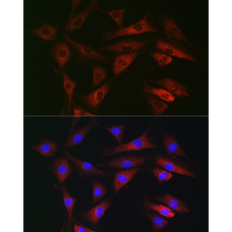 Immunofluorescence - Anti-RAB1B Antibody (A309223) - Antibodies.com