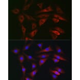 Immunofluorescence - Anti-RAB1B Antibody (A309223) - Antibodies.com