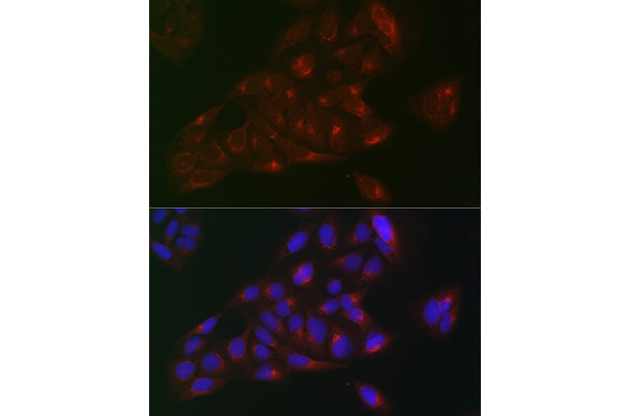 Immunofluorescence - Anti-RAB1B Antibody (A309223) - Antibodies.com
