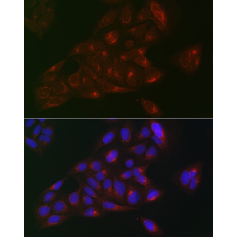 Immunofluorescence - Anti-RAB1B Antibody (A309223) - Antibodies.com