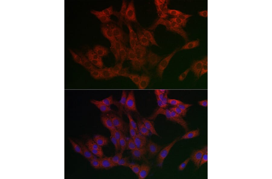 Immunofluorescence - Anti-UBXD8 Antibody (A309224) - Antibodies.com