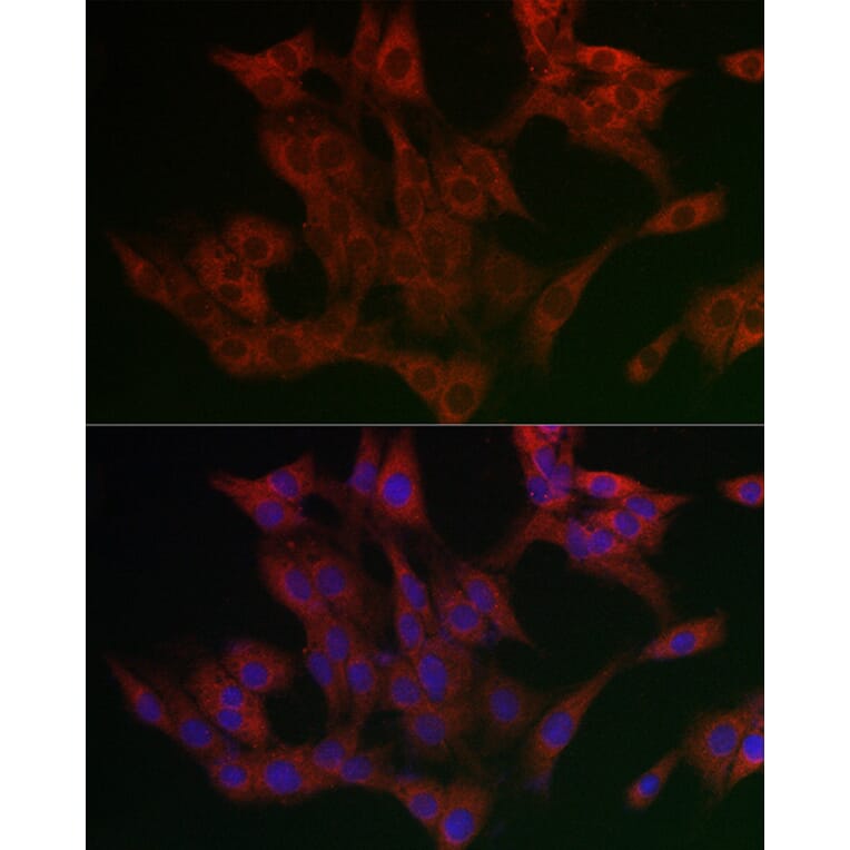 Immunofluorescence - Anti-UBXD8 Antibody (A309224) - Antibodies.com