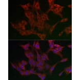 Immunofluorescence - Anti-UBXD8 Antibody (A309224) - Antibodies.com