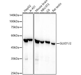 Western Blot - Anti-GLUD1 + GLUD2 Antibody [ARC53980] (A309225) - Antibodies.com