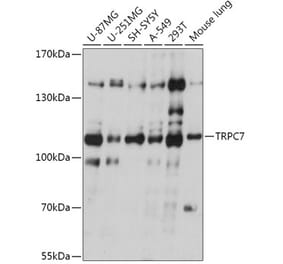 Western Blot - Anti-TRP 7 Antibody (A309226) - Antibodies.com