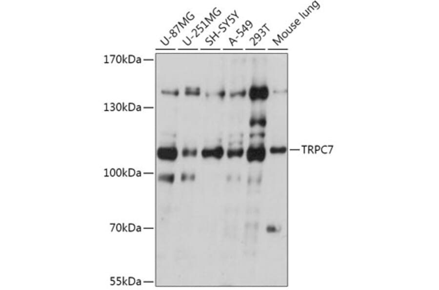 Western Blot - Anti-TRP 7 Antibody (A309226) - Antibodies.com