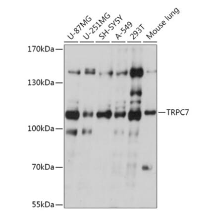 Western Blot - Anti-TRP 7 Antibody (A309226) - Antibodies.com