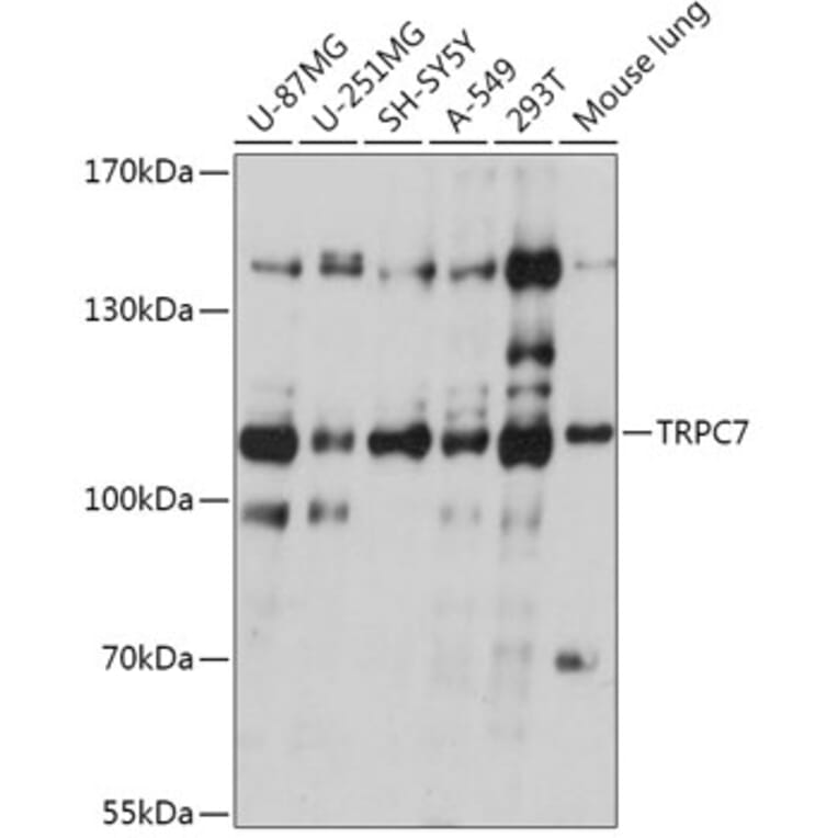 Western Blot - Anti-TRP 7 Antibody (A309226) - Antibodies.com