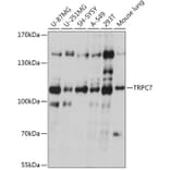 Western Blot - Anti-TRP 7 Antibody (A309226) - Antibodies.com