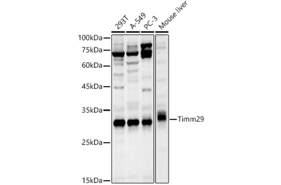 Western Blot - Anti-Timm29 Antibody (A309227) - Antibodies.com