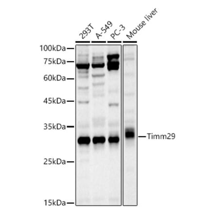 Western Blot - Anti-Timm29 Antibody (A309227) - Antibodies.com