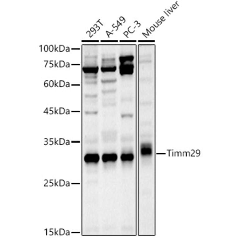 Western Blot - Anti-Timm29 Antibody (A309227) - Antibodies.com