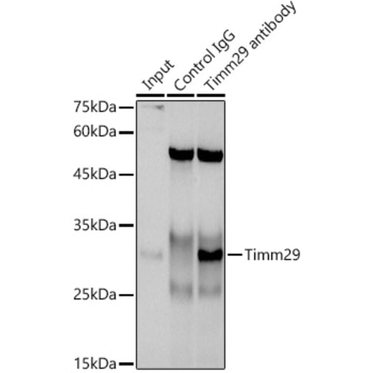 Western Blot - Anti-Timm29 Antibody (A309227) - Antibodies.com