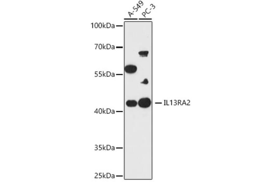 Western Blot - Anti-IL-13 receptor alpha 2 Antibody (A309228) - Antibodies.com