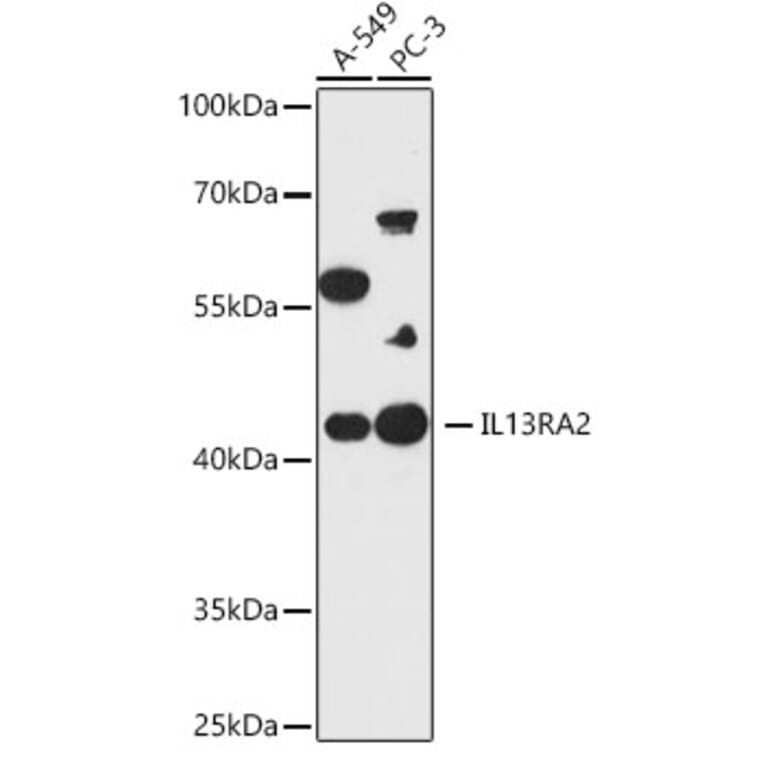Western Blot - Anti-IL-13 receptor alpha 2 Antibody (A309228) - Antibodies.com