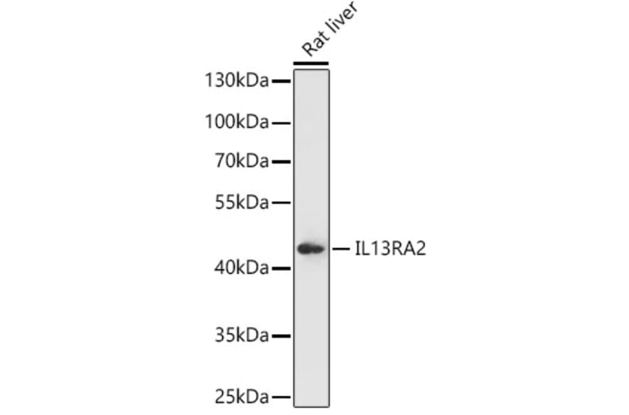 Western Blot - Anti-IL-13 receptor alpha 2 Antibody (A309228) - Antibodies.com