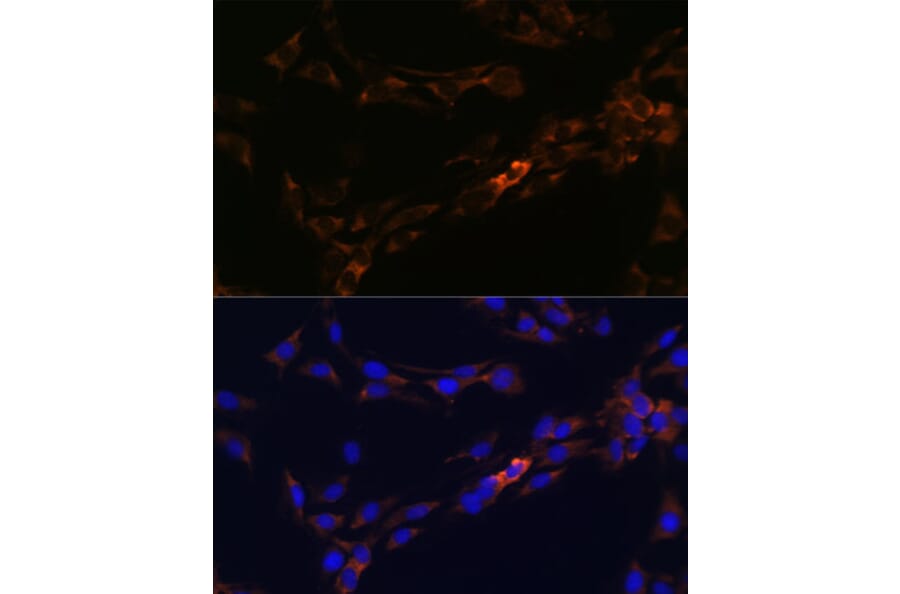 Immunofluorescence - Anti-IL-13 receptor alpha 2 Antibody (A309228) - Antibodies.com