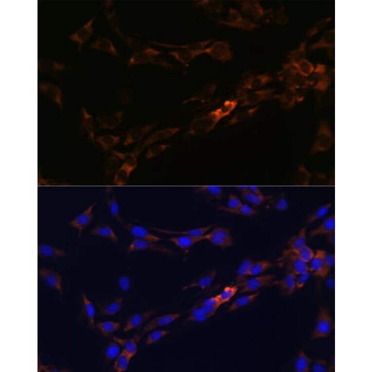 Immunofluorescence - Anti-IL-13 receptor alpha 2 Antibody (A309228) - Antibodies.com