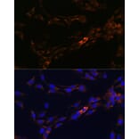 Immunofluorescence - Anti-IL-13 receptor alpha 2 Antibody (A309228) - Antibodies.com